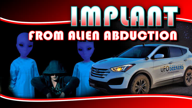 ALIEN ABDUCTEE Discovers Implant Hole S1 E15 UFO