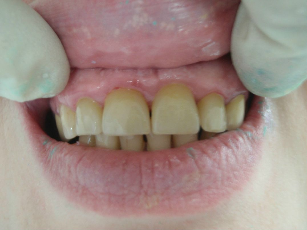 Эрнест Абрамян | Москва