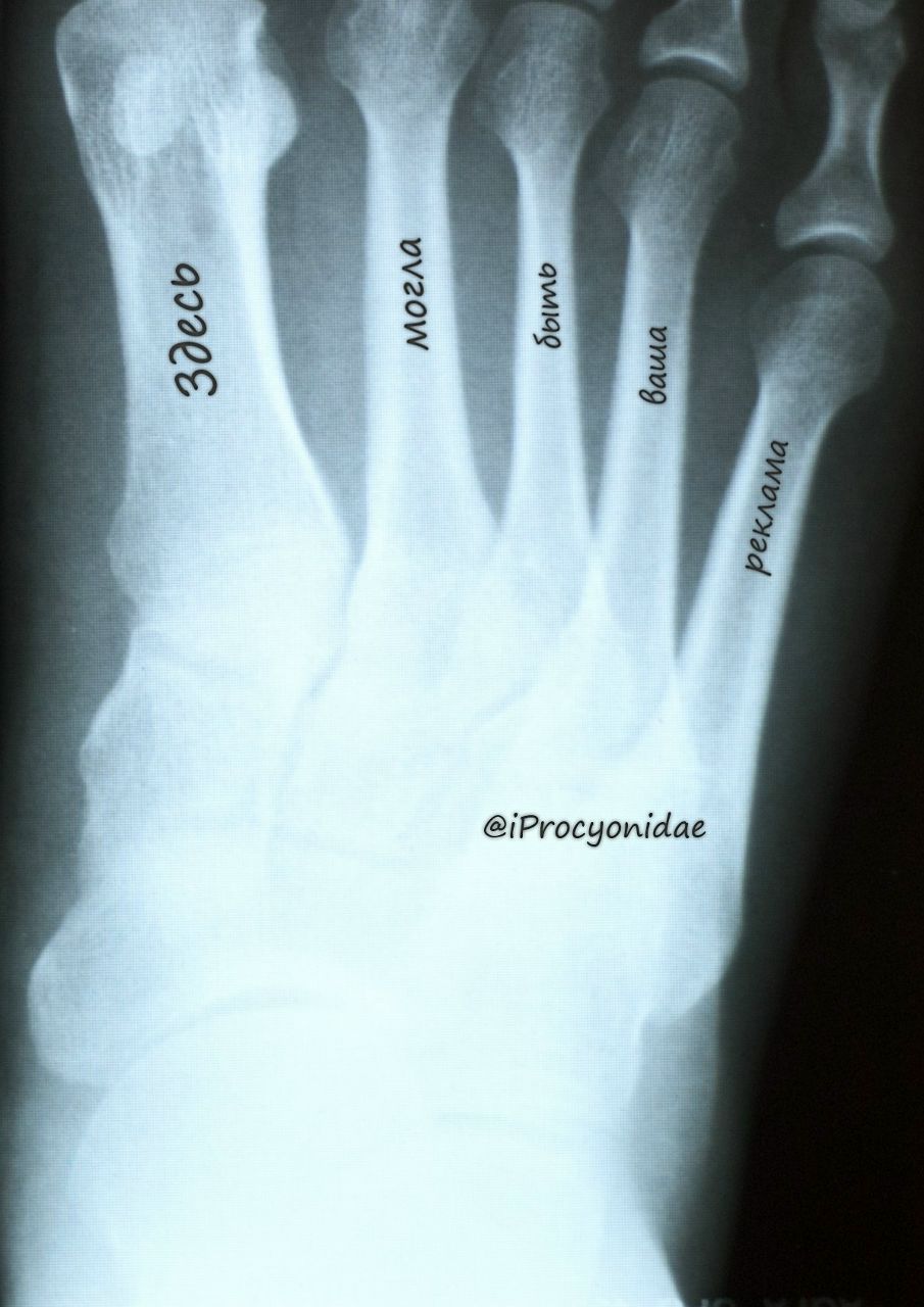 Михаил Забалуев | Красноярск