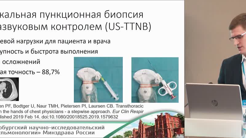 Трансторакальные биопсии в диагностике опухолей